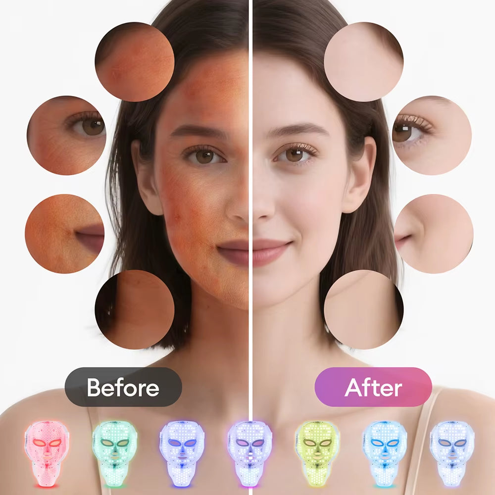 LED Red Light Therapy Face Mask — 7 Color Photon Skin Rejuvenation & Anti-Aging Home Treatment